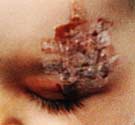 Lausanne Boy Lausanne pit bull attack