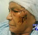 Maria Zaldana Maria Zaldana, pit bull attack