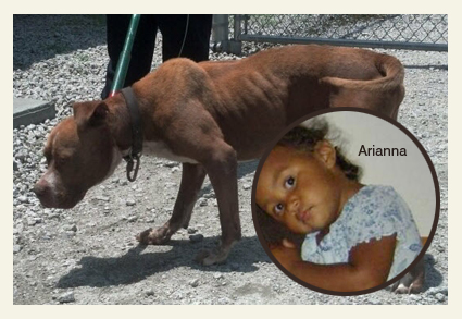 5-year old child was attacked by a chained pit bull