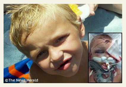 callaway boy mauled by pit bull mix dogs dies