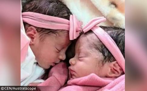 pit bull kills twins in brazil