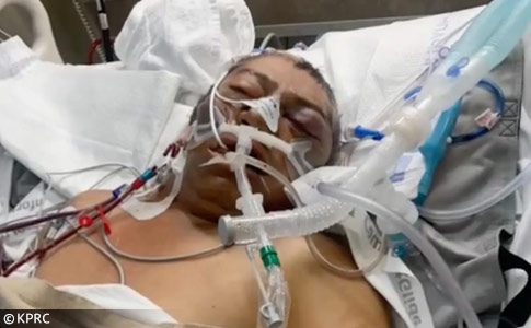 Nicolas Vasquez, multiple amputations, pit bull attack